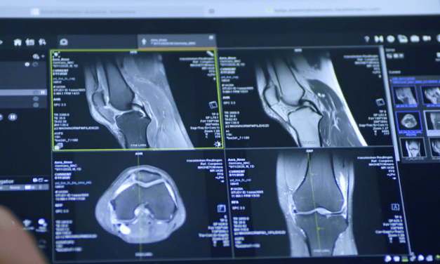 <strong>SmartSimulator: simulazione per la radiologia</strong>