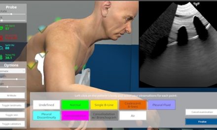 <strong>Lung Ultrasound Simulator, a free tool for lung ultrasound simulations</strong>